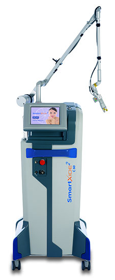 SMART XIDE 0035 hårtransplantation